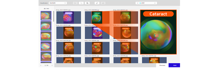 A fundus image classification tool interface showing image 25 of 469. Fundus photographs are displayed in a grid layout. The selected image is enlarged on the right side, showing a classification result labeled Cataract with an orange label.