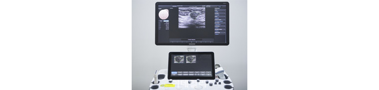 Samsung Medison’s S-Detect system image. Use for Ultrasound Video and CT/MRI Analysis. 