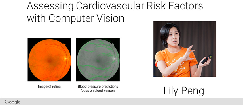 Use case 01 - 안저 사진을 통한 심혈관 위험 측정