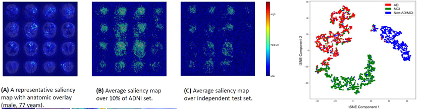 A Deep Learning Model for Early Prediction of the Diagnosis of Alzheimer Disease : 18-FDG-PET Scan 사진 분석을 인공 신경망을 통해 수행